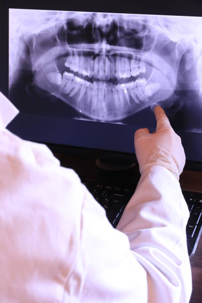 Best Emergency Tooth Extraction in Trinity, AL